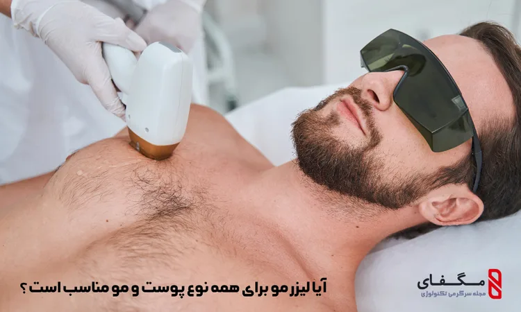 آیا لیزر مو برای همه نوع پوست و مو مناسب است؟